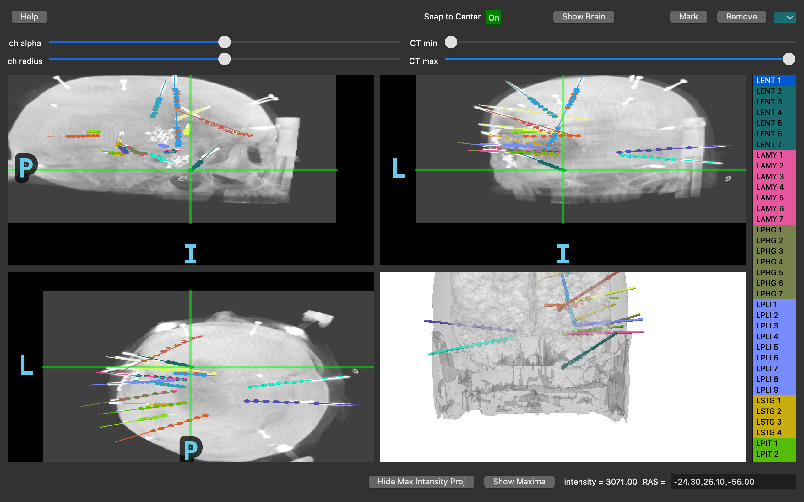 MNE ieeg figure